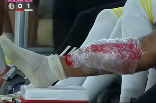 Florinel Coman s-a accidentat în duelul cu echipa lui Cosmin Contra » Exces de zel al arbitrului