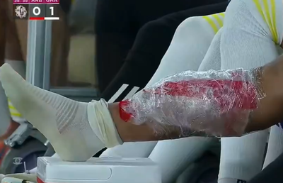 Florinel Coman s-a accidentat în duelul cu echipa lui Cosmin Contra » Exces de zel al arbitrului