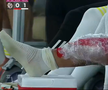 Piciorul lui Florinel Coman, accidentat în Al Arabi - Al Gharafa / Foto: captură de ecran Twitter