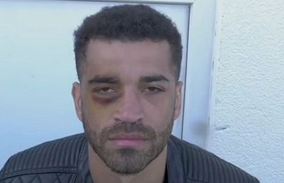 VIDEO S-a făcut KO singur! Un campion european și-a învinețit ochiul în direct pe internet