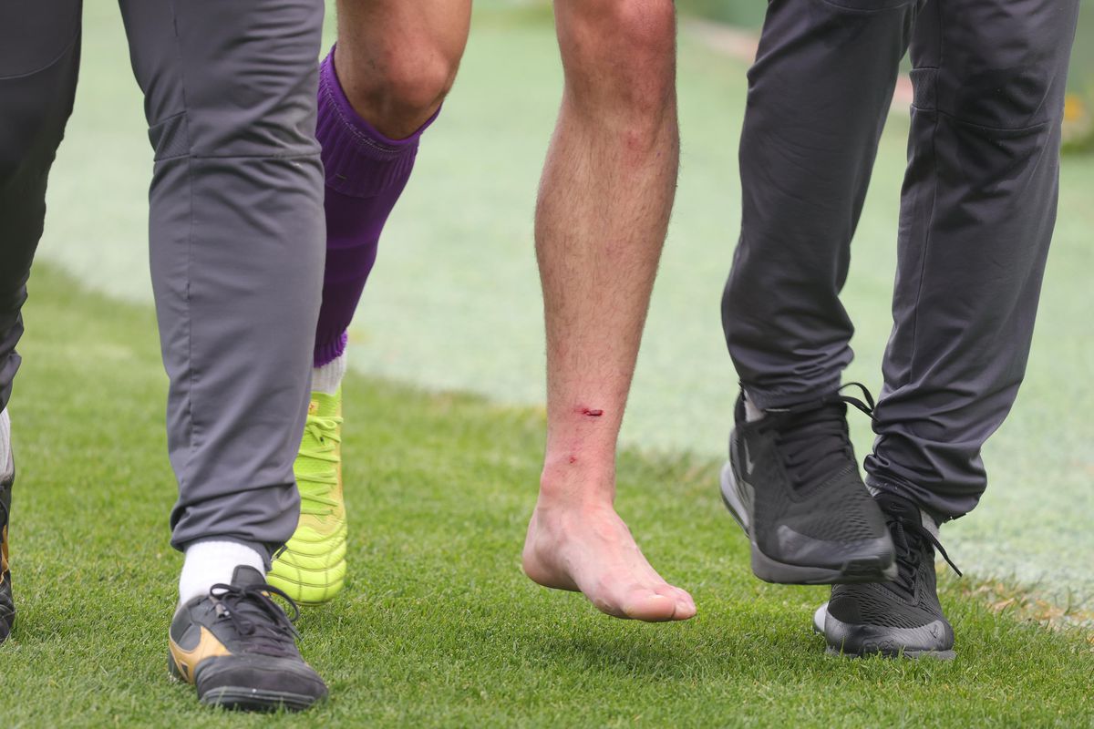 Bogdan Andone a dat diagnosticul pentru Yanis Pîrvu, după accidentarea horror de la Voluntari