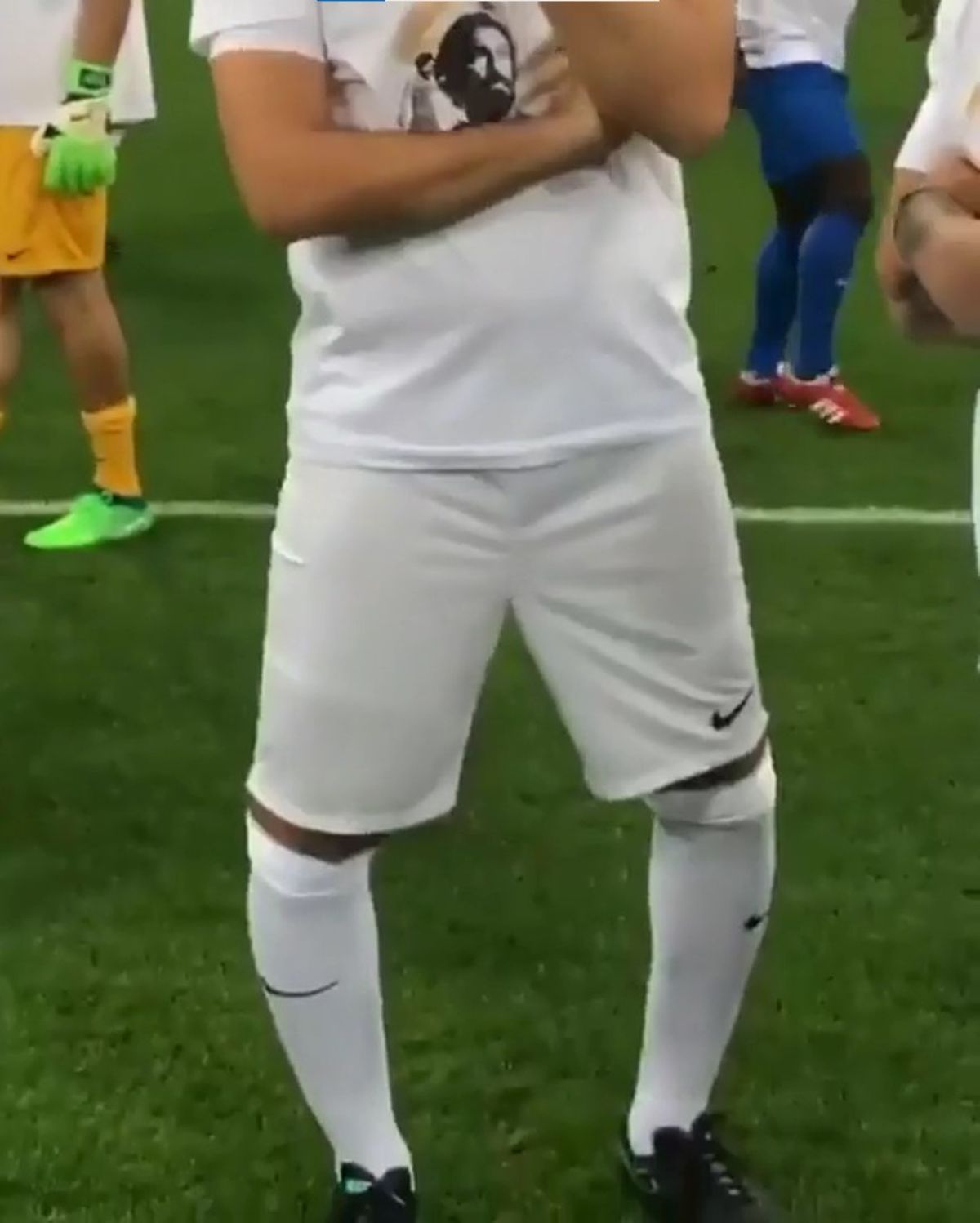 Gianluca Zambrotta abia mai poate umbla din cauza strâmbării teribile a picioarelor!