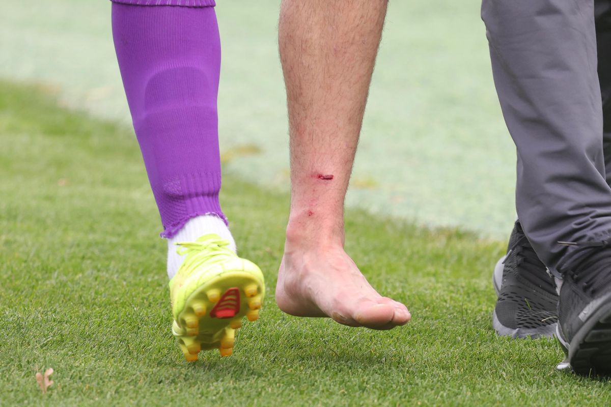 Bogdan Andone a dat diagnosticul pentru Yanis Pîrvu, după accidentarea horror de la Voluntari