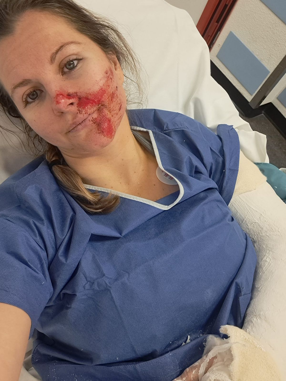 Schioarea Ania Monica Caill a ajuns la spital plină de sânge după ultimul antrenament » Prima reacție a sportivei