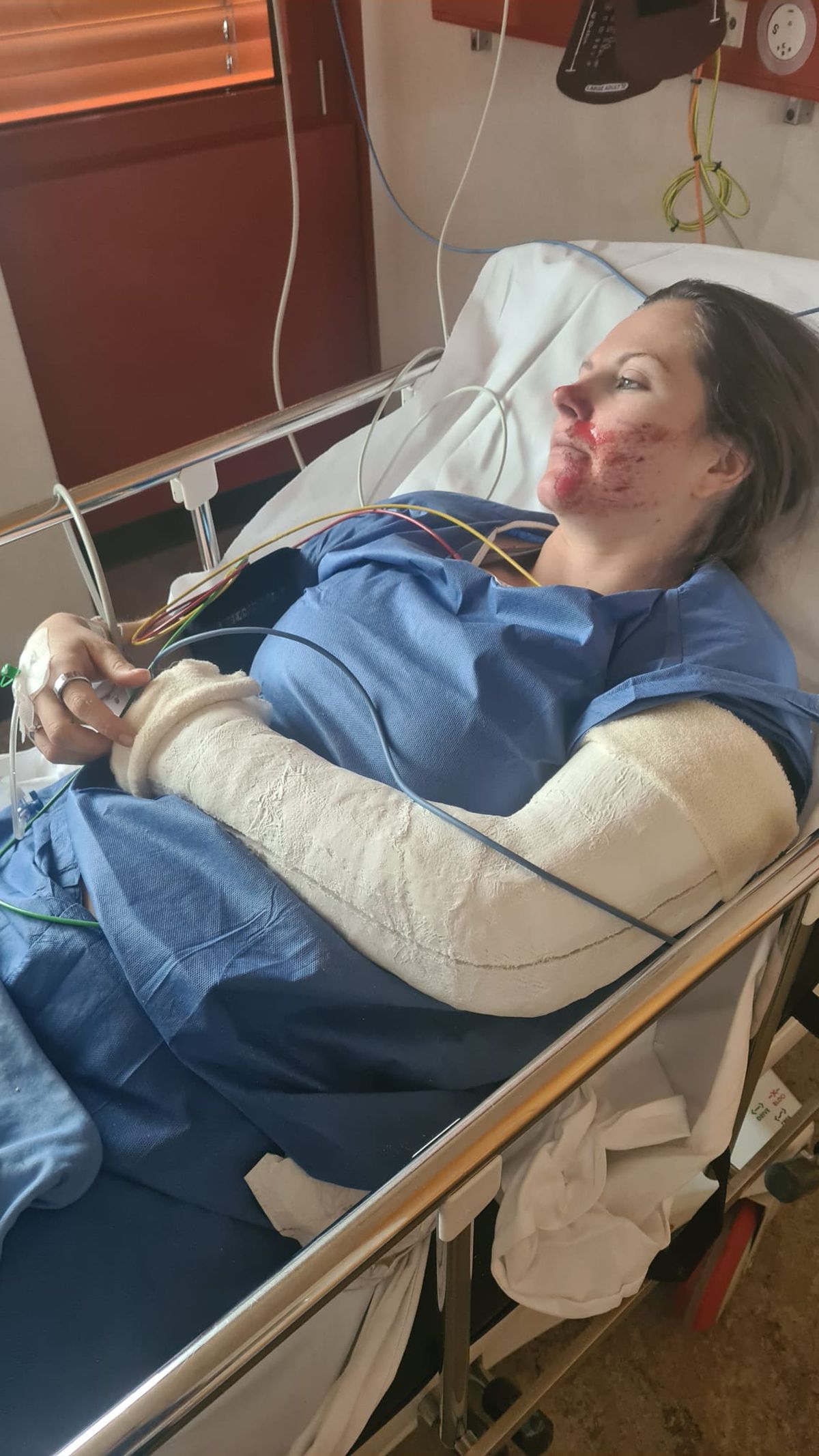 Schioarea Ania Monica Caill a ajuns la spital plină de sânge după ultimul antrenament » Prima reacție a sportivei