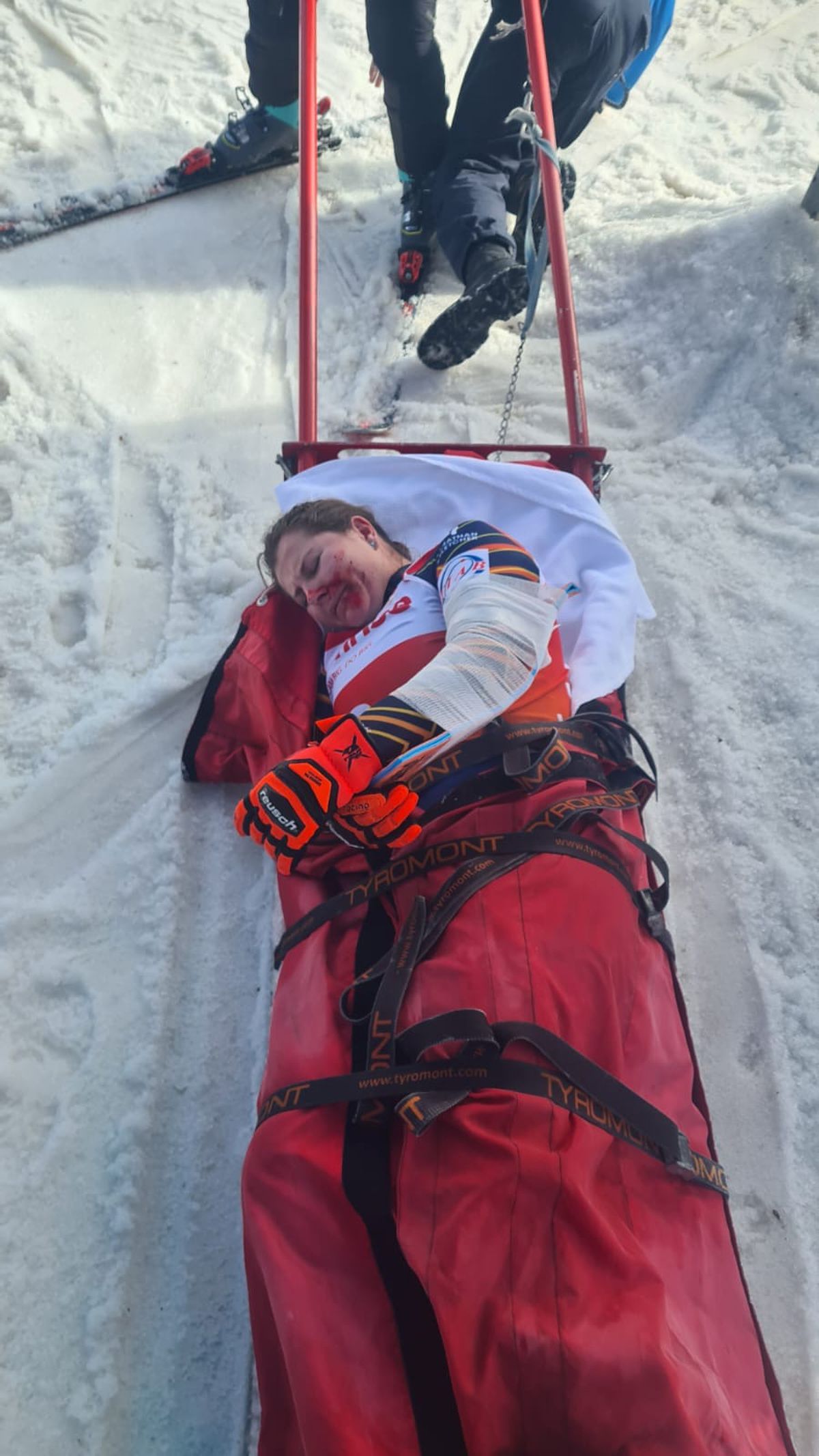 Schioarea Ania Monica Caill a ajuns la spital plină de sânge după ultimul antrenament » Prima reacție a sportivei