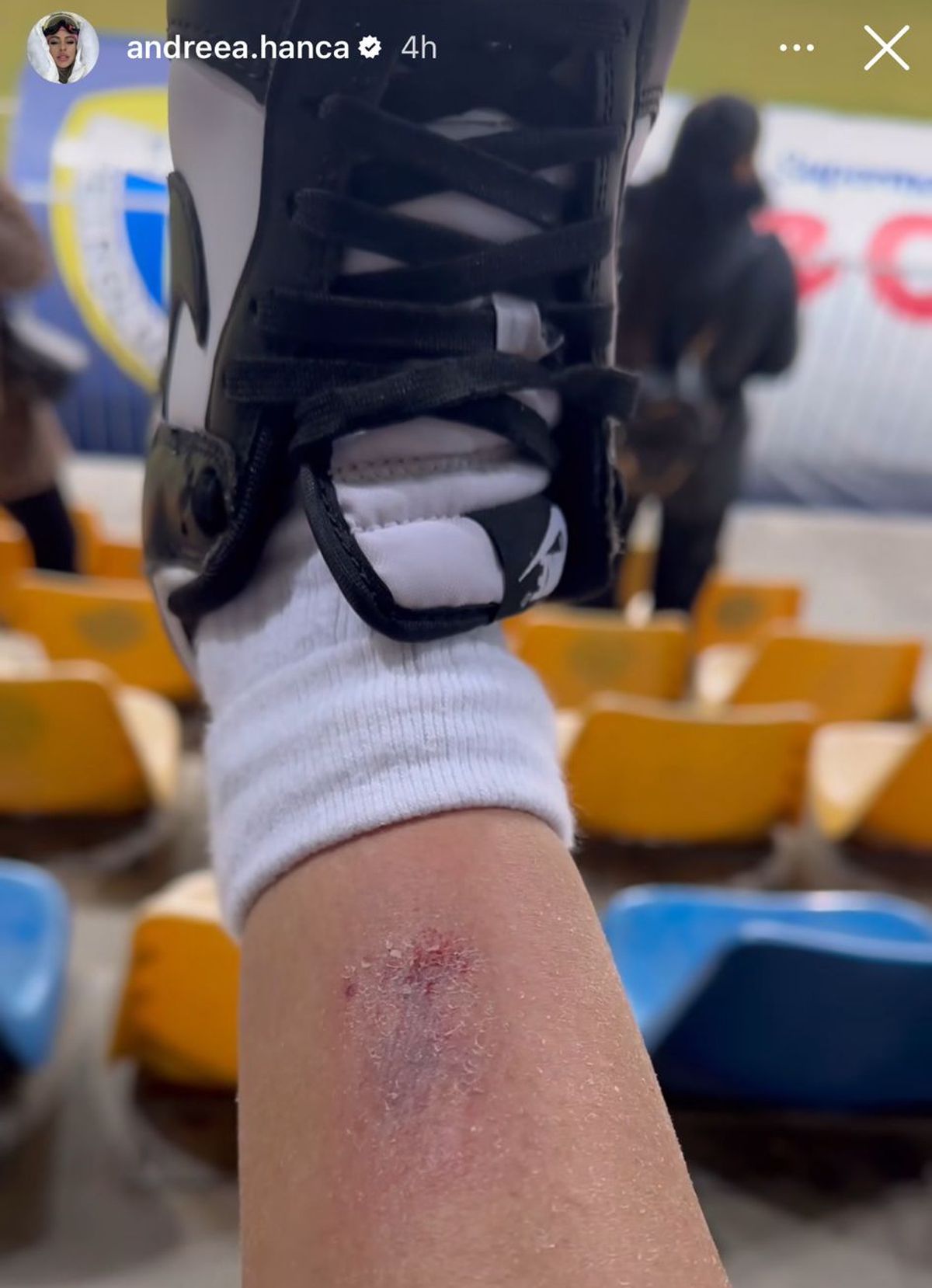 Petrolul - Poli Iași 2-1. Andreea Hanca