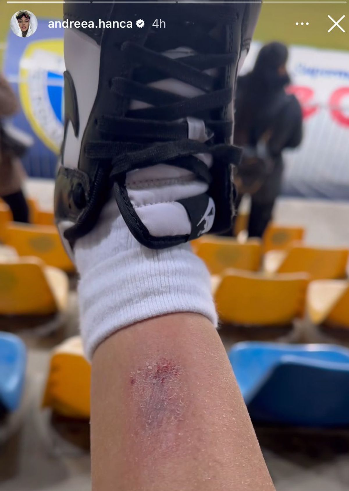 Petrolul - Poli Iași 2-1. Andreea Hanca