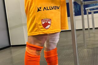 Cu un bandaj mare și „o gaură în genunchi”, Roșca a spus cum s-a văzut cea mai incertă fază direct din poartă: „E 100%”