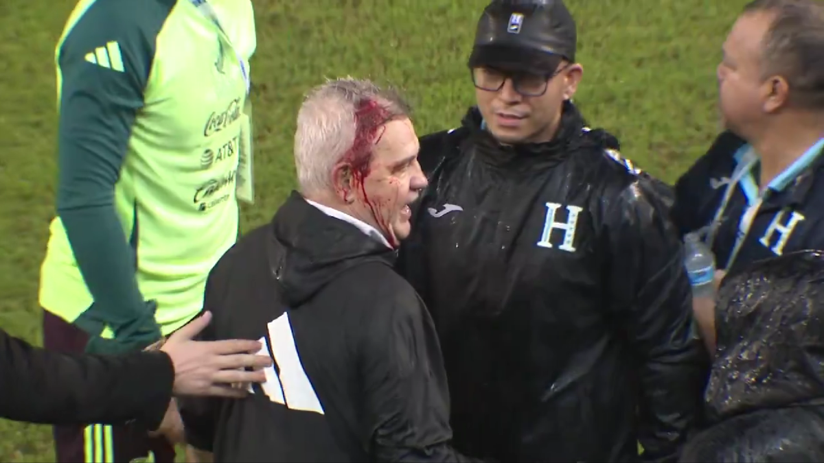 IMAGINE HORROR! » Selecționerul a fost umplut de sânge pe gazon, după ce a fost lovit în cap după meci