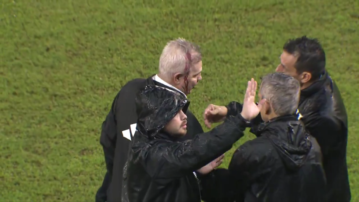 IMAGINE HORROR! » Selecționerul a fost umplut de sânge pe gazon, după ce a fost lovit în cap după meci