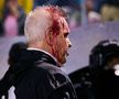 Javier Aguirre (65 de ani), selecționerul Mexicului, a fost umplut de sânge de un fan, după meciul pierdut în Honduras cu scorul de 0-2, în Liga Națiunilor CONCACAF.