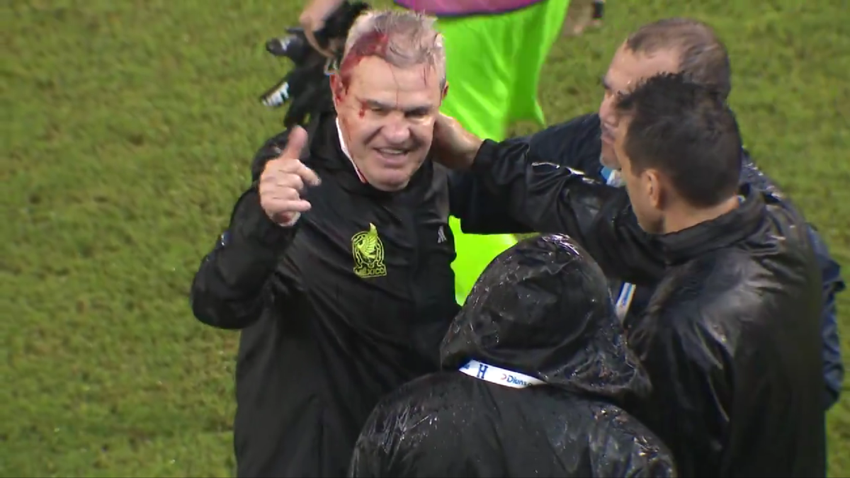 IMAGINE HORROR! » Selecționerul a fost umplut de sânge pe gazon, după ce a fost lovit în cap după meci