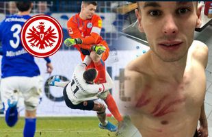 Schalke - Frankfurt 1-0 // Mijat Gaćinovic, contuzii severe la coaste după cel mai brutal fault al anului: „Nübel merită măcar 6 etape!”