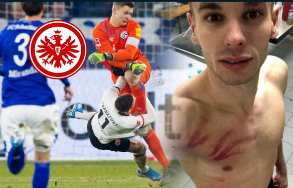 Schalke - Frankfurt 1-0 // Mijat Gaćinovic, contuzii severe la coaste după cel mai brutal fault al anului: „Nübel merită măcar 6 etape!”