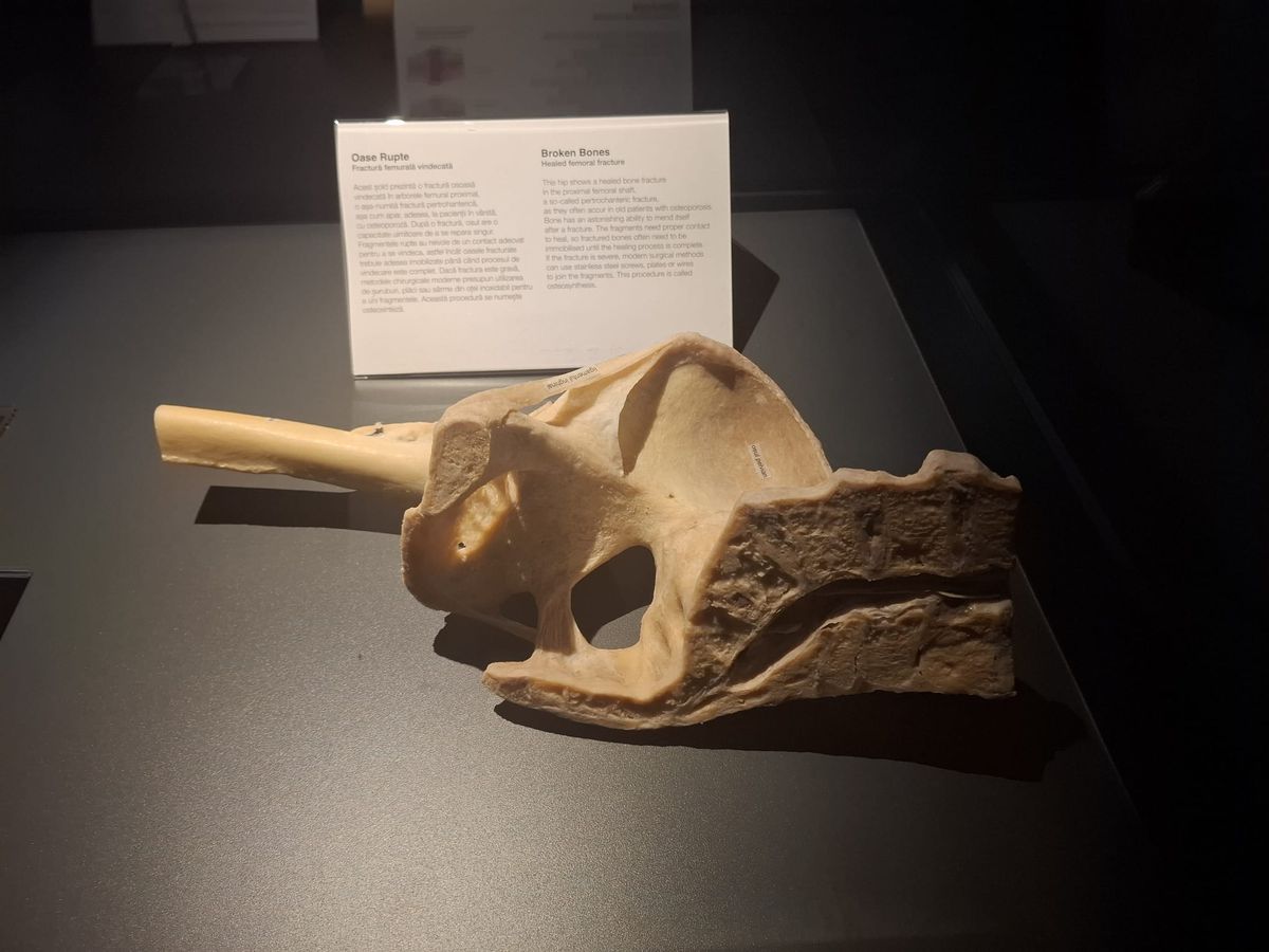 Știință pură și șocantă la București » Controversata expoziție de cadavre plastinate „BODY WORLDS Vital” prezintă corpul omenesc în cele mai mici amănunte, cu exemple din lumea sportului