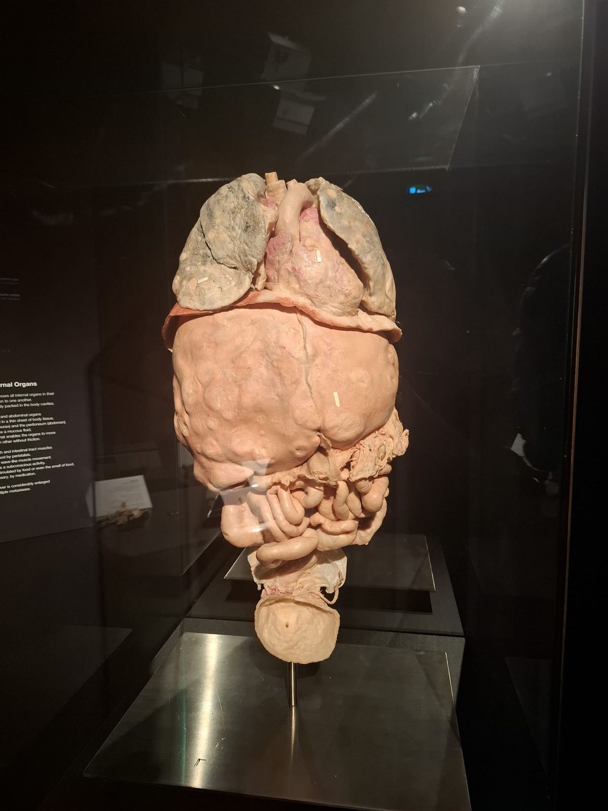 Expoziția Body Worlds Vitals de la București
