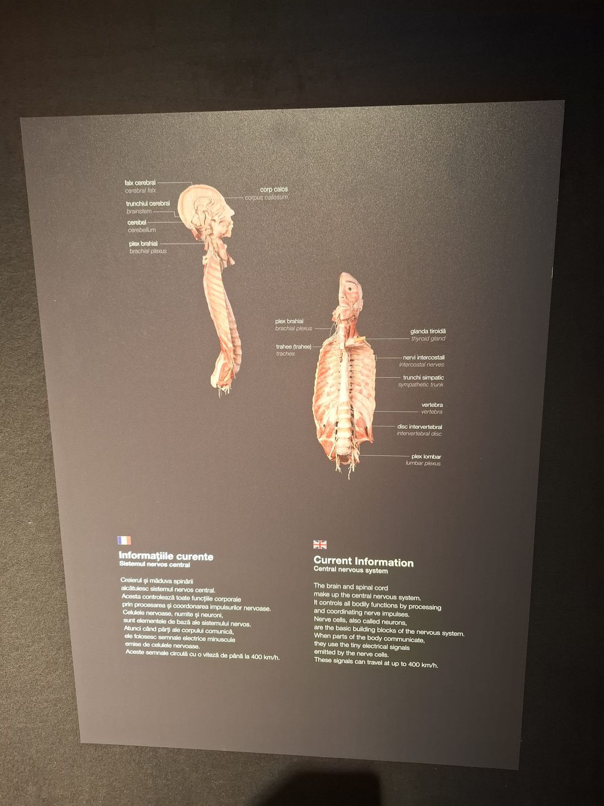 Știință pură și șocantă la București » Controversata expoziție de cadavre plastinate „BODY WORLDS Vital” prezintă corpul omenesc în cele mai mici amănunte, cu exemple din lumea sportului