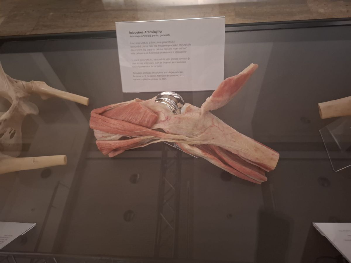 Știință pură și șocantă la București » Controversata expoziție de cadavre plastinate „BODY WORLDS Vital” prezintă corpul omenesc în cele mai mici amănunte, cu exemple din lumea sportului