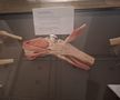 Știință pură și șocantă la București » Controversata expoziție de cadavre plastinate „BODY WORLDS Vital” prezintă corpul omenesc în cele mai mici amănunte, cu exemple din lumea sportului