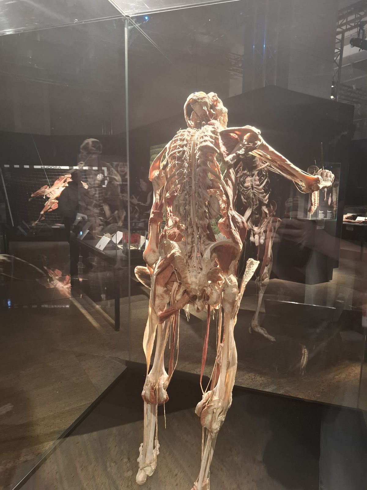 Știință pură și șocantă la București » Controversata expoziție de cadavre plastinate „BODY WORLDS Vital” prezintă corpul omenesc în cele mai mici amănunte, cu exemple din lumea sportului