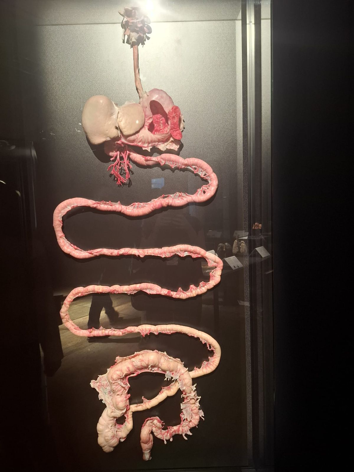 Expoziția Body Worlds Vitals de la București