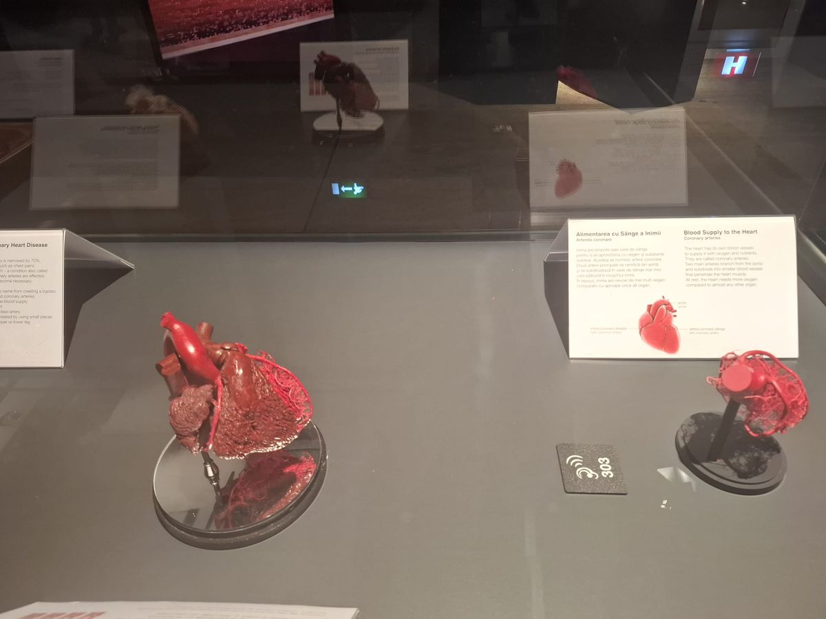 Știință pură și șocantă la București » Controversata expoziție de cadavre plastinate „BODY WORLDS Vital” prezintă corpul omenesc în cele mai mici amănunte, cu exemple din lumea sportului