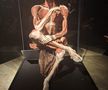 Știință pură și șocantă la București » Controversata expoziție de cadavre plastinate „BODY WORLDS Vital” prezintă corpul omenesc în cele mai mici amănunte, cu exemple din lumea sportului