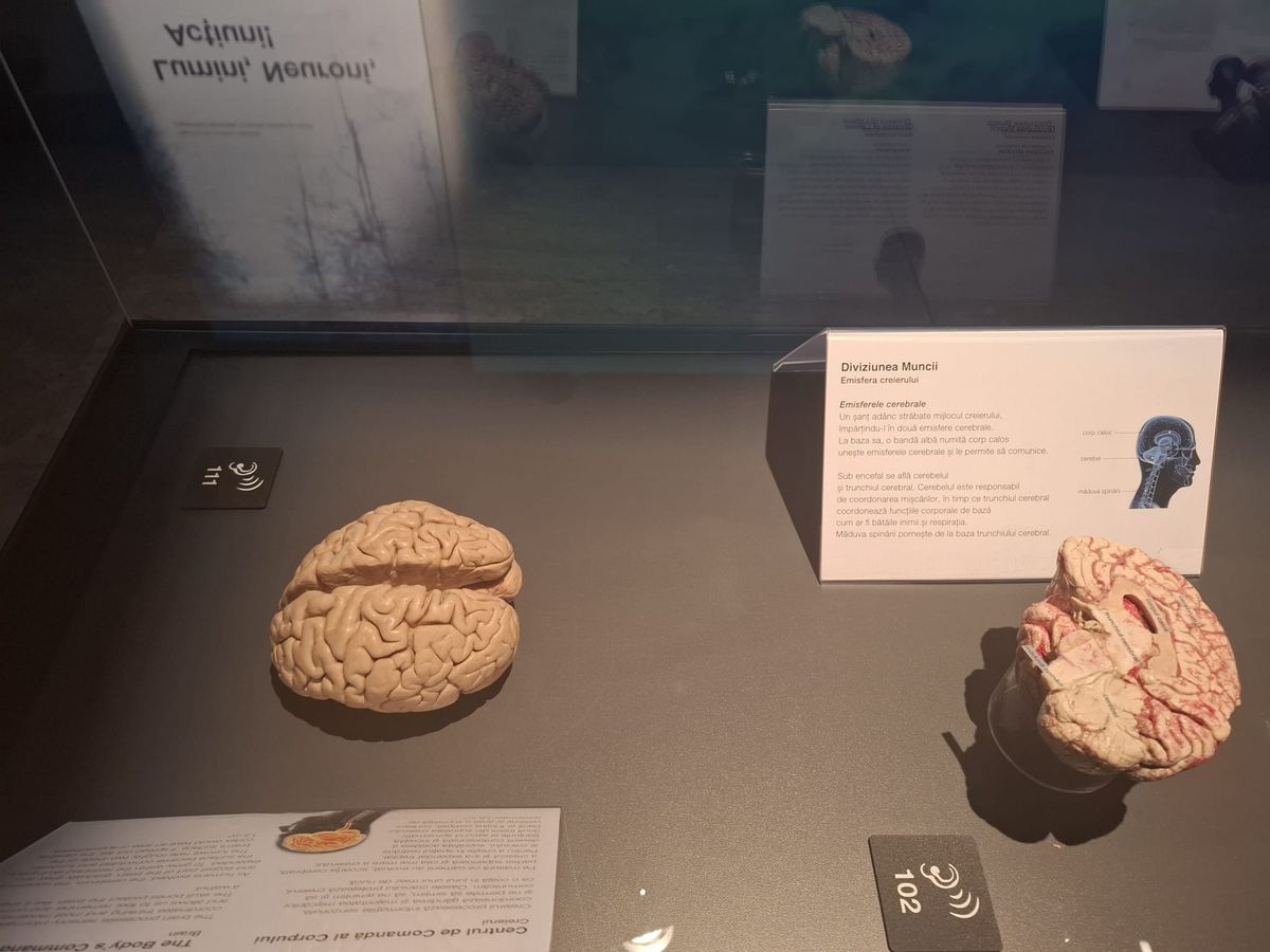 Știință pură și șocantă la București » Controversata expoziție de cadavre plastinate „BODY WORLDS Vital” prezintă corpul omenesc în cele mai mici amănunte, cu exemple din lumea sportului