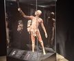 Știință pură și șocantă la București » Controversata expoziție de cadavre plastinate „BODY WORLDS Vital” prezintă corpul omenesc în cele mai mici amănunte, cu exemple din lumea sportului