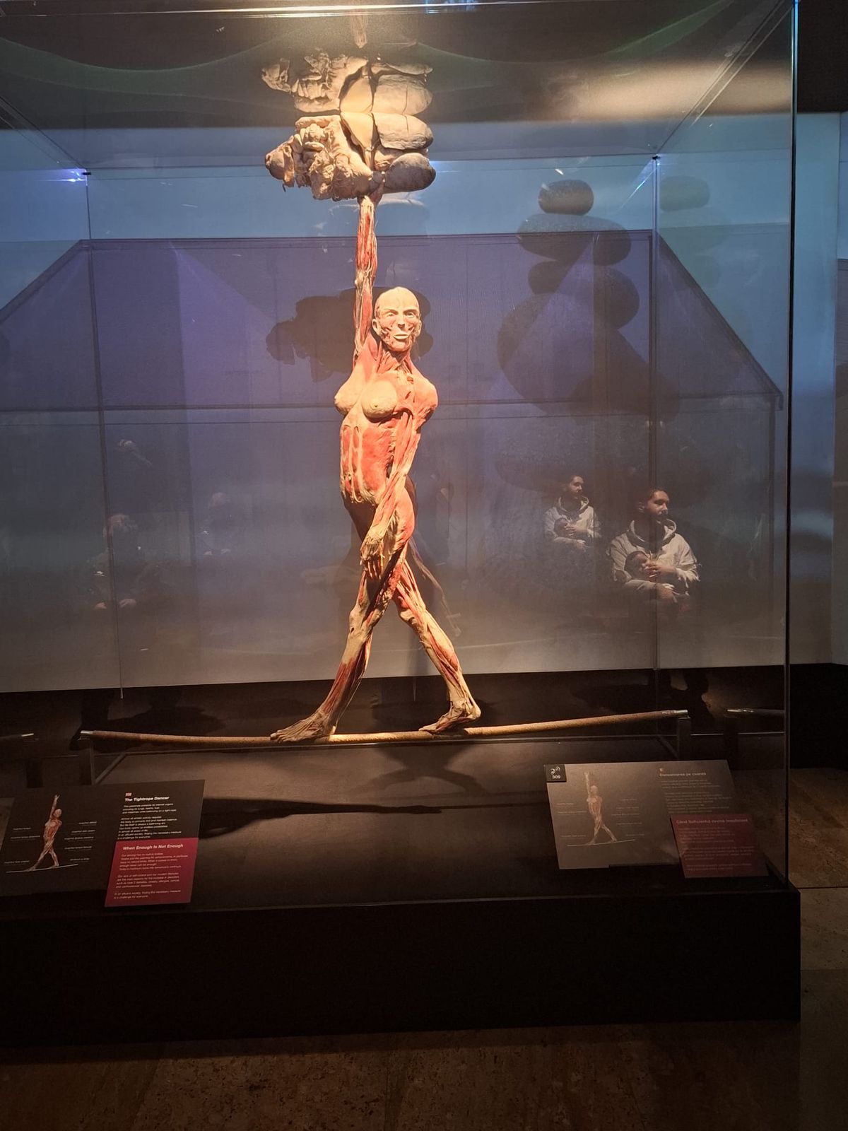 Știință pură și șocantă la București » Controversata expoziție de cadavre plastinate „BODY WORLDS Vital” prezintă corpul omenesc în cele mai mici amănunte, cu exemple din lumea sportului
