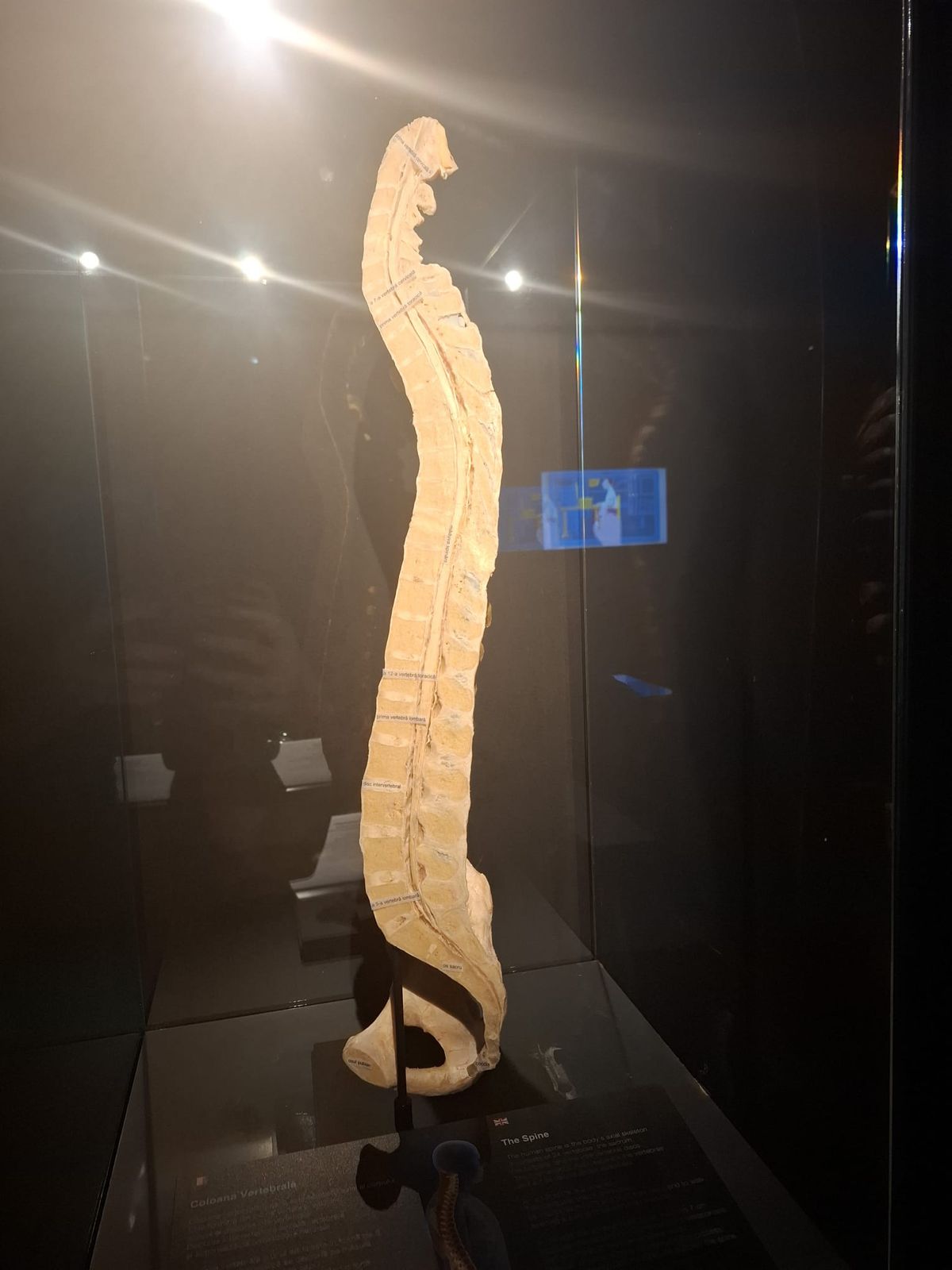 Știință pură și șocantă la București » Controversata expoziție de cadavre plastinate „BODY WORLDS Vital” prezintă corpul omenesc în cele mai mici amănunte, cu exemple din lumea sportului