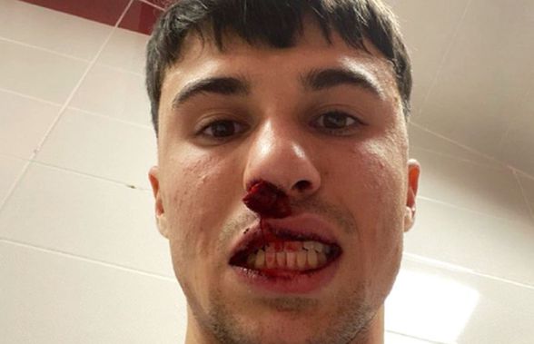 Șocant! Fotbalist din Serie A, atacat și lovit de un huligan după meciul din Conference League: „E o rușine! I-a rupt nasul!”