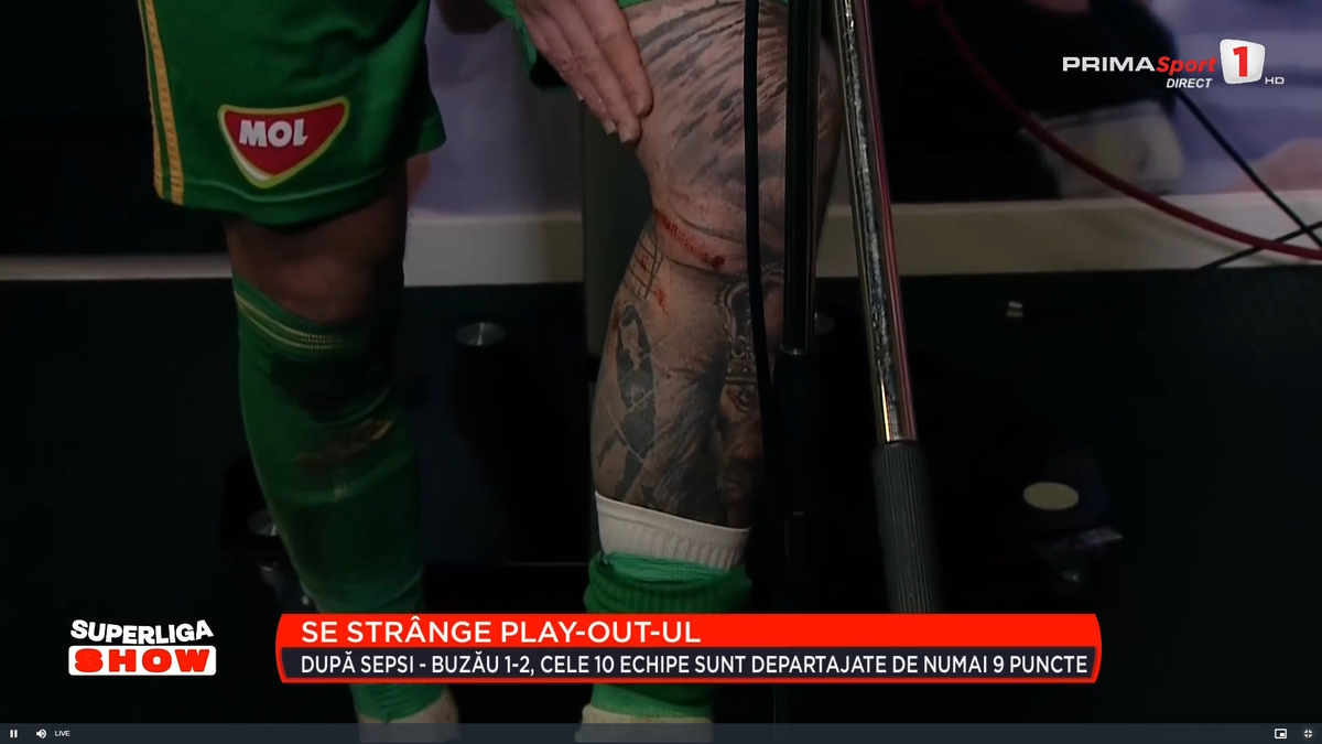 Cum arată piciorul lui Niczuly, după contactul dur cu Luckassen: „Aproape mi-a rupt genunchiul, iar domnul Avram spune că a fost o mică controversă”