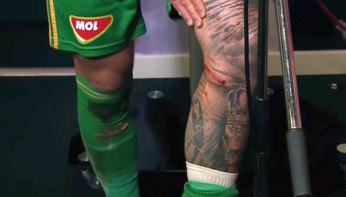 Cum arată piciorul lui Niczuly, după contactul cu Luckassen