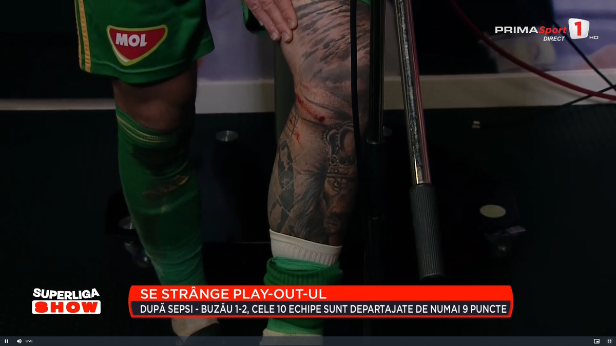 Cum arată piciorul lui Niczuly, după contactul cu Luckassen