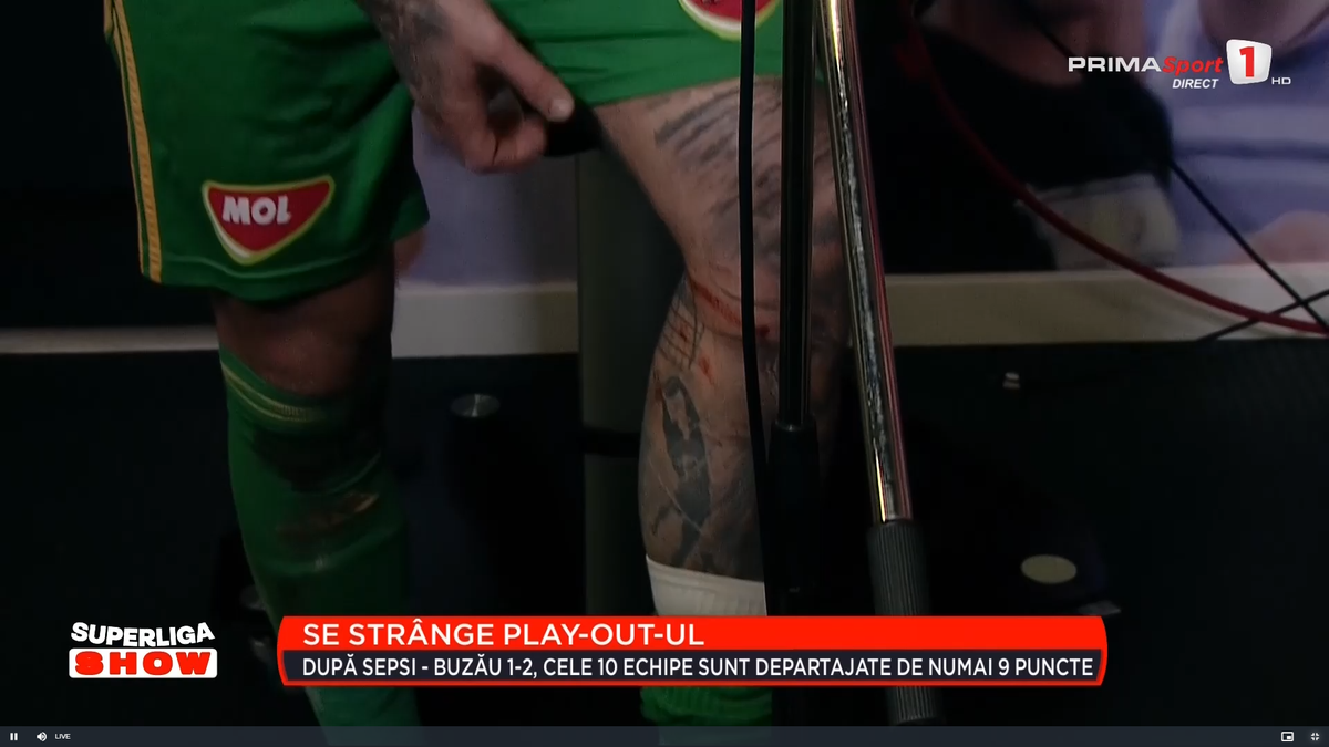 Cum arată piciorul lui Niczuly, după contactul dur cu Luckassen: „Aproape mi-a rupt genunchiul, iar domnul Avram spune că a fost o mică controversă”