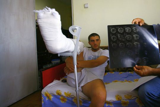În vara lui 2008, la câteva zile după accidentare, o echipă a Gazetei l-a vizitat pe Monel Cârstoiu la Pitești. Înconjurat de familie, fotbalistul avea piciorul imobilizat, iar durerile nu-i dădeau pace / Sursă foto: Arhivă GSP