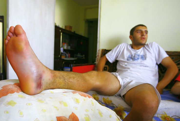 În vara lui 2008, la câteva zile după accidentare, o echipă a Gazetei l-a vizitat pe Monel Cârstoiu la Pitești. Înconjurat de familie, fotbalistul avea piciorul imobilizat, iar durerile nu-i dădeau pace / Sursă foto: Arhivă GSP