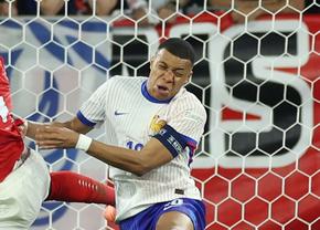 A ajuns DE URGENȚĂ la spital! Kylian Mbappe nu va mai fi însă operat la nasul rupt aseară + Câte meciuri va lipsi căpitanul Franței