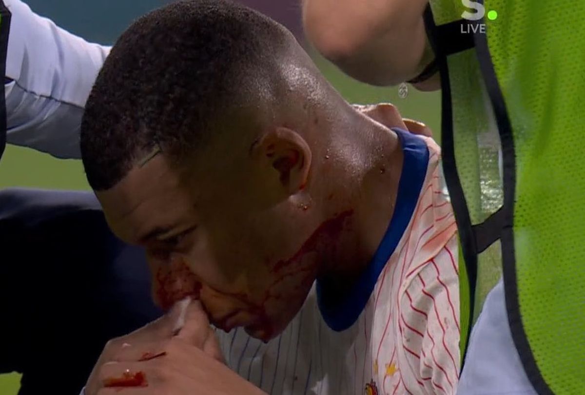 Mbappe, lovit în Franța - Austria