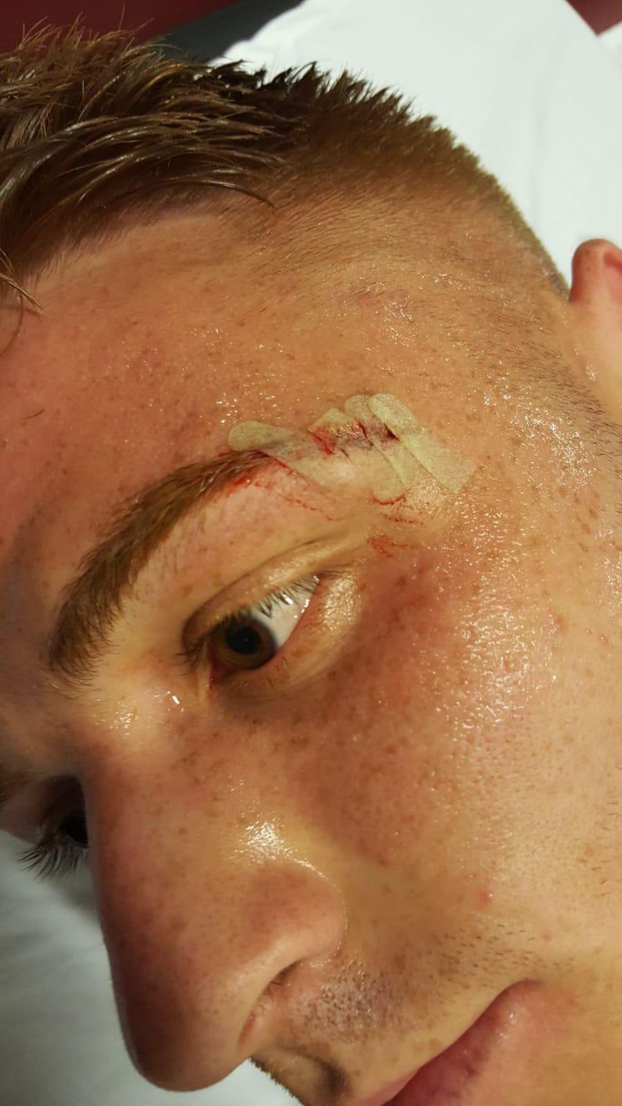 Greșeală de arbitraj în CFR Cluj - Sepsi: „Ai dovada la fața locului!” + cum arată rana „victimei”