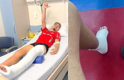 Cum arată stângul lui Dragoș Iancu: nici n-ai zice că a suferit o fractură deschisă!