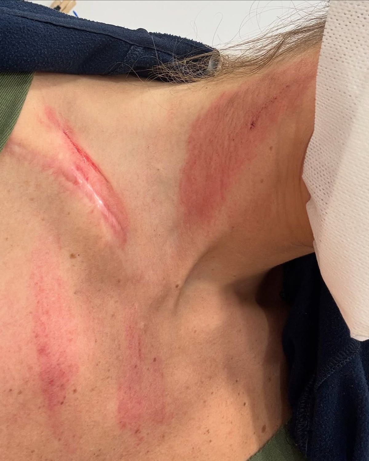 Plină de vânătăi » Sportiva le-a arătat fanilor în Marca rănile suferite: „Știu că după ploaie iese soarele”