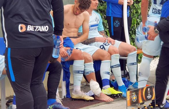 Răzdan Oaidă s-a accidentat în amicalul FCSB - Karlsruher SC