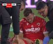 Dennis Politic, accidentat în Dinamo - Oțelul