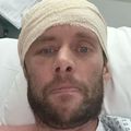 David Smith, după ce a fost operat pe creier // foto: Instagram