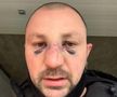 VIDEO EXCLUSIV Fost kickboxer român, snopit în bătaie în plină stradă de un fost pugilist: „A încercat să mă înjunghie!”