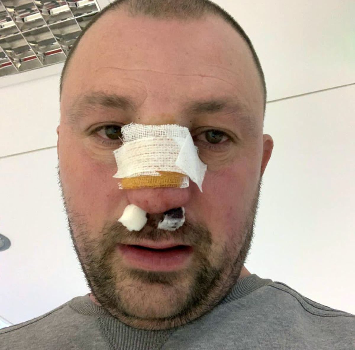 VIDEO EXCLUSIV Fost kickboxer român, snopit în bătaie în plină stradă de un fost pugilist: „A încercat să mă înjunghie!”