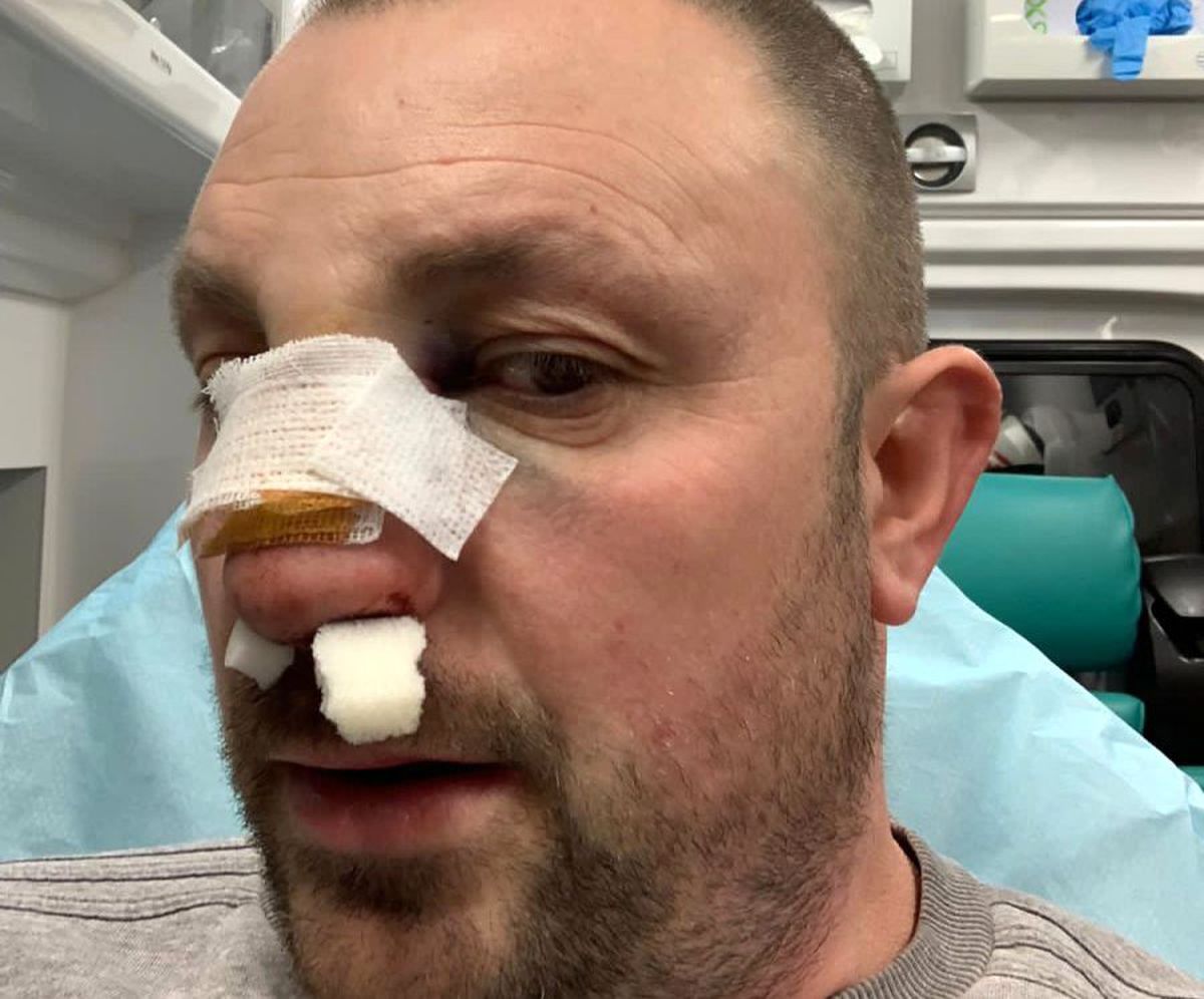 VIDEO EXCLUSIV Fost kickboxer român, snopit în bătaie în plină stradă de un fost pugilist: „A încercat să mă înjunghie!”